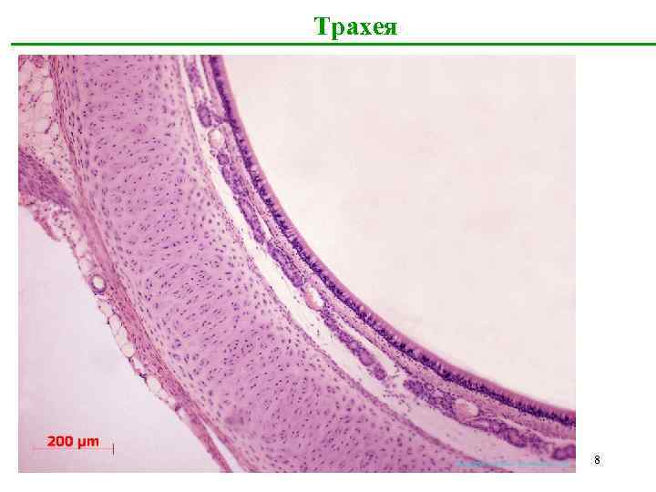 Трахея 8 