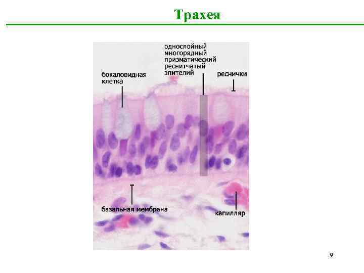 Трахея 9 