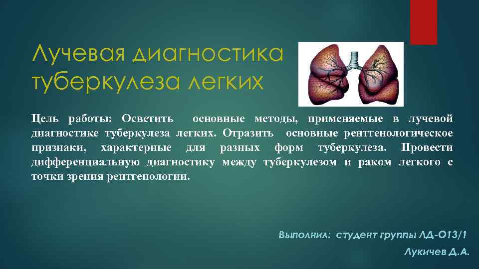 Лучевая диагностика туберкулеза легких Цель работы: Осветить основные методы, применяемые в лучевой диагностике туберкулеза
