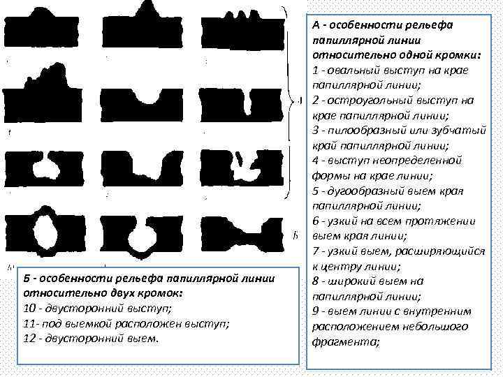 Б - особенности рельефа папиллярной линии относительно двух кромок: 10 - двусторонний выступ; 11