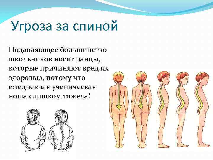 Угроза за спиной Подавляющее большинство школьников носят ранцы, которые причиняют вред их здоровью, потому