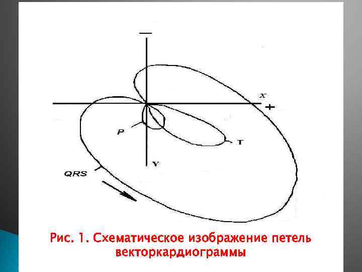 Рис. 1. Схематическое изображение петель векторкардиограммы 