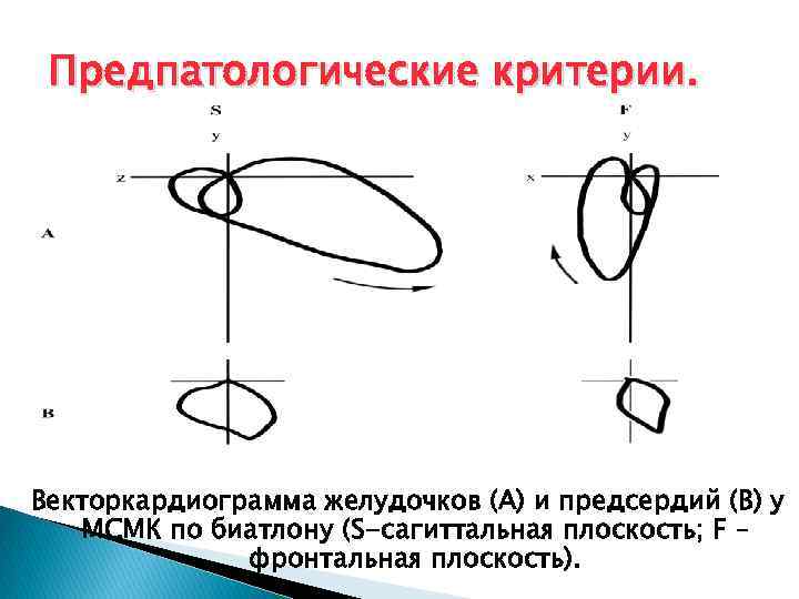 Предпатологические критерии. Векторкардиограмма желудочков (А) и предсердий (В) у МСМК по биатлону (S-сагиттальная плоскость;