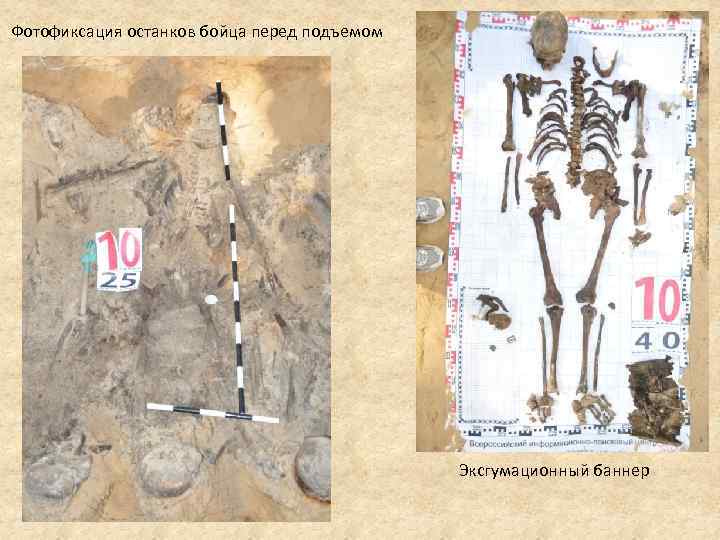 Фотофиксация останков бойца перед подъемом Эксгумационный баннер 