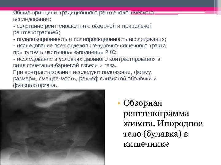 Общие принципы традиционного рентгенологического исследования: - сочетание рентгеноскопии с обзорной и прицельной рентгенографией; -