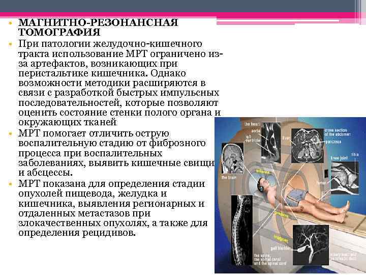  • МАГНИТНО-РЕЗОНАНСНАЯ ТОМОГРАФИЯ • При патологии желудочно-кишечного тракта использование МРТ ограничено изза артефактов,