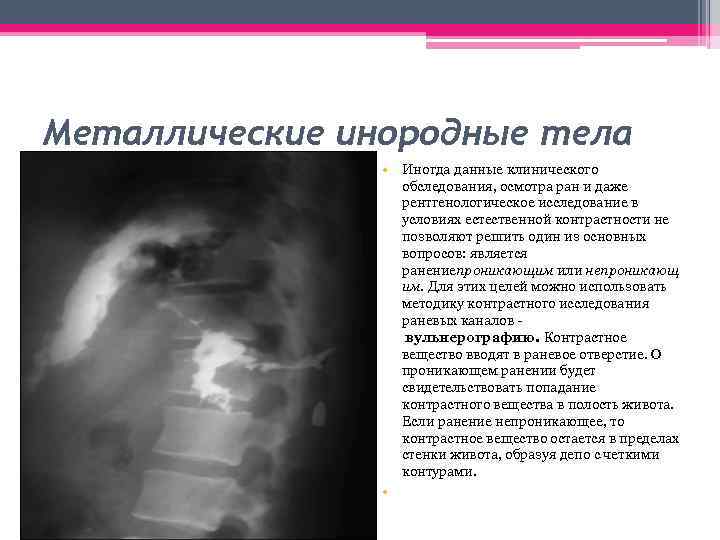 Металлические инородные тела • Иногда данные клинического обследования, осмотра ран и даже рентгенологическое исследование