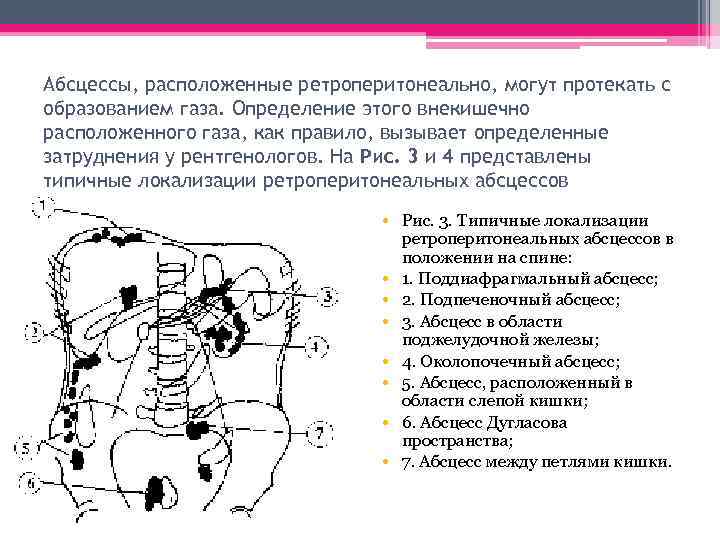 Абсцессы, расположенные ретроперитонеально, могут протекать с образованием газа. Определение этого внекишечно расположенного газа, как