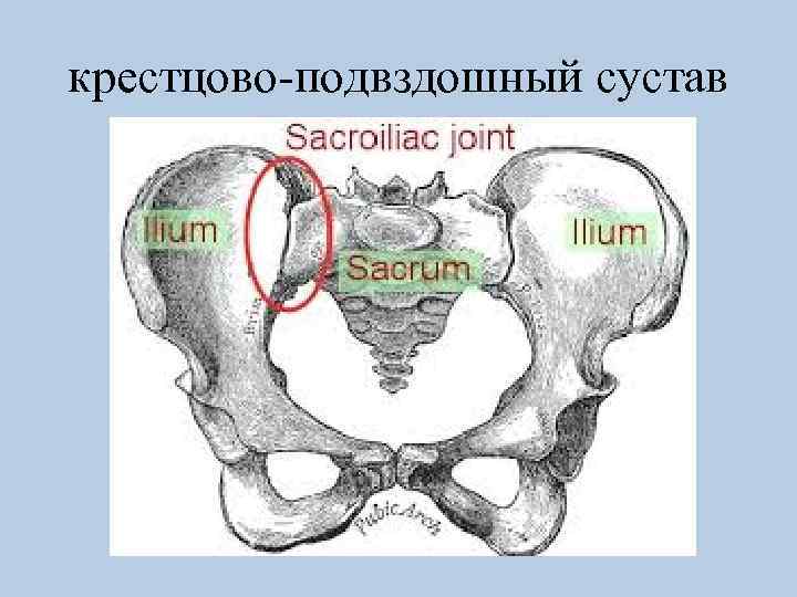 крестцово-подвздошный сустав 