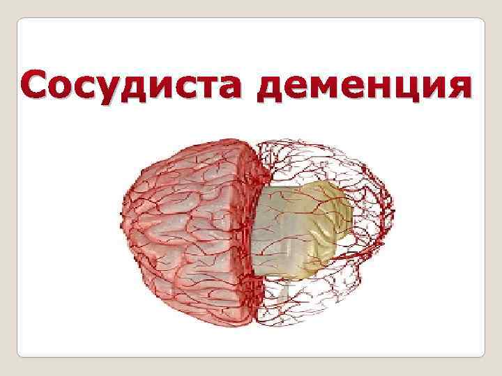 Сосудиста деменция 