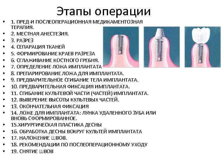  • • • • • Этапы операции 1. ПРЕД-И ПОСЛЕОПЕРАЦИОННАЯ МЕДИКАМЕНТОЗНАЯ ТЕРАПИЯ. 2.