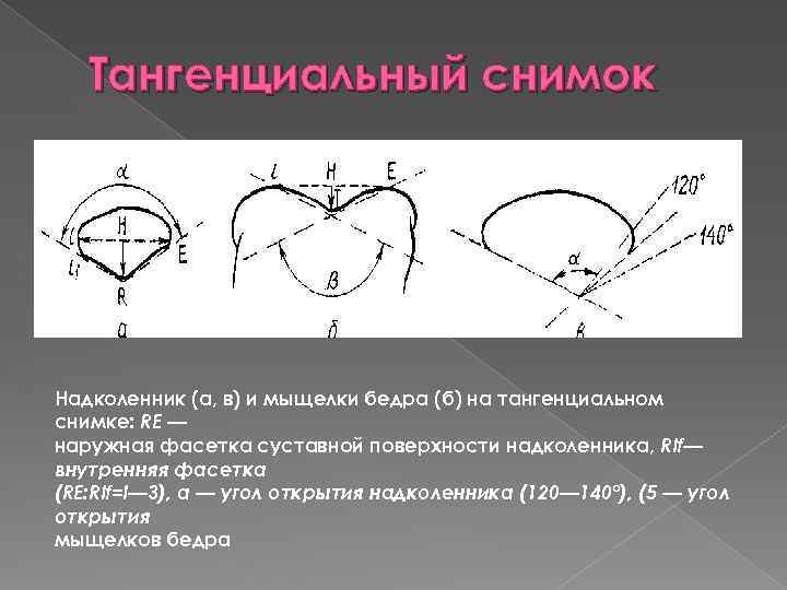 Перелом надколенника карта вызова