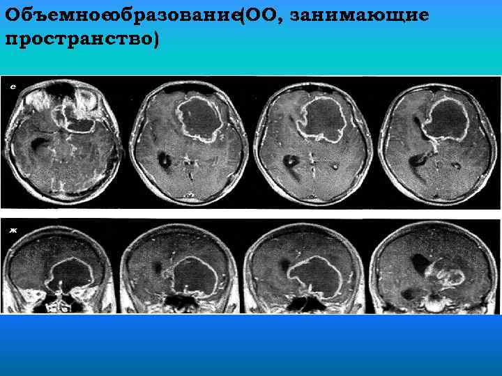 Объемноеобразование (ОО, занимающие пространство) 