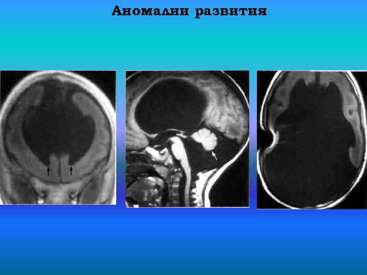 Аномалии развития 