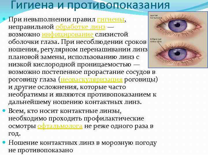 Гигиена и противопоказания При невыполнении правил гигиены, неправильной обработке линз — возможно инфицирование слизистой