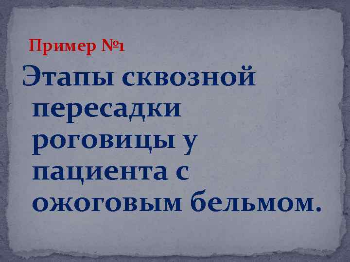 Пример № 1 Этапы сквозной пересадки роговицы у пациента с ожоговым бельмом. 