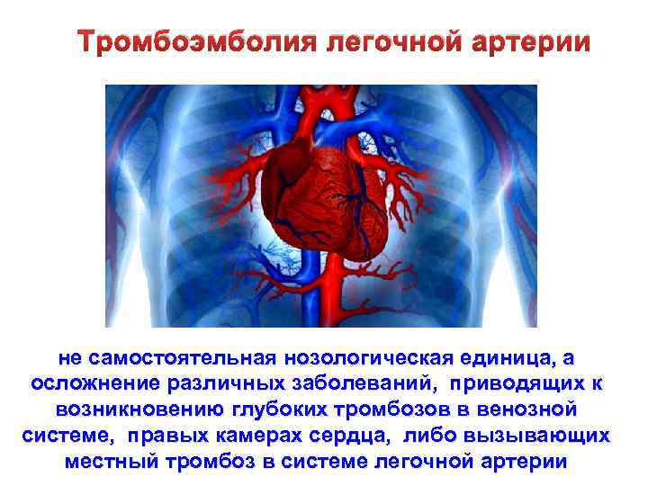 Тромбоэмболия легочной артерии прогноз
