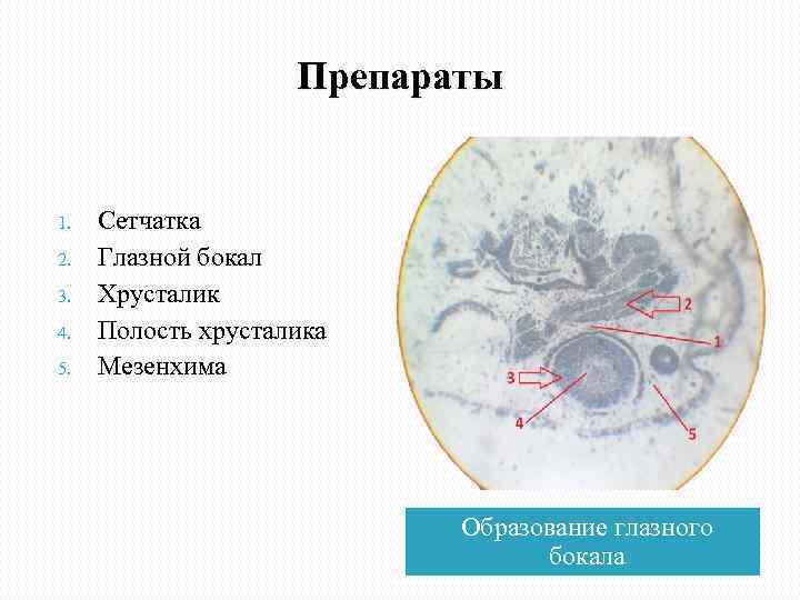 Препараты 1. 2. 3. 4. 5. Сетчатка Глазной бокал Хрусталик Полость хрусталика Мезенхима Образование