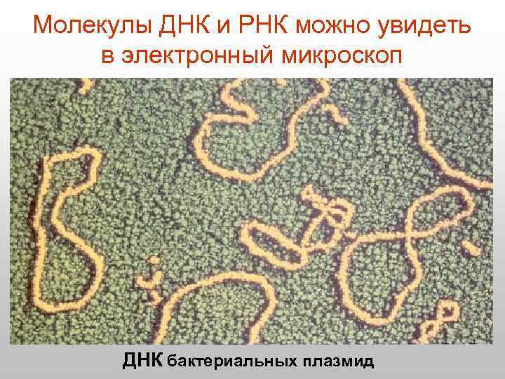 Молекулы ДНК и РНК можно увидеть в электронный микроскоп ДНК бактериальных плазмид 