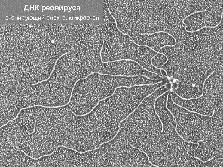 ДНК реовируса сканирующий электр. микроскоп 