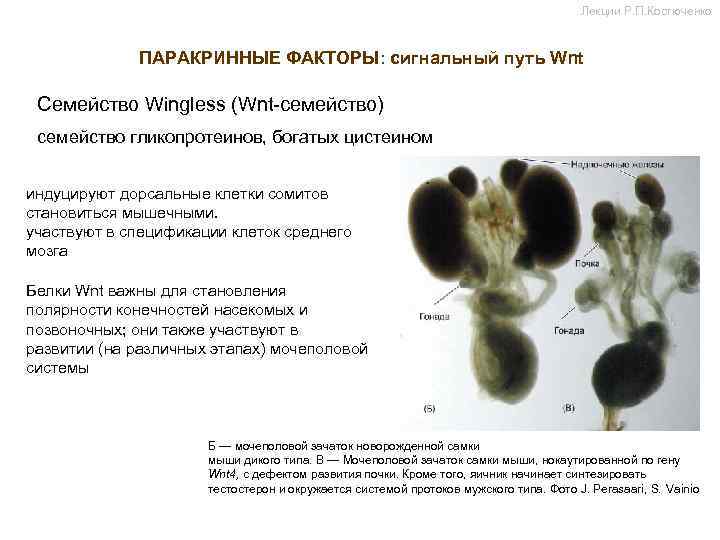 Лекции Р. П. Костюченко ПАРАКРИННЫЕ ФАКТОРЫ: сигнальный путь Wnt Семейство Wingless (Wnt-семейство) семейство гликопротеинов,