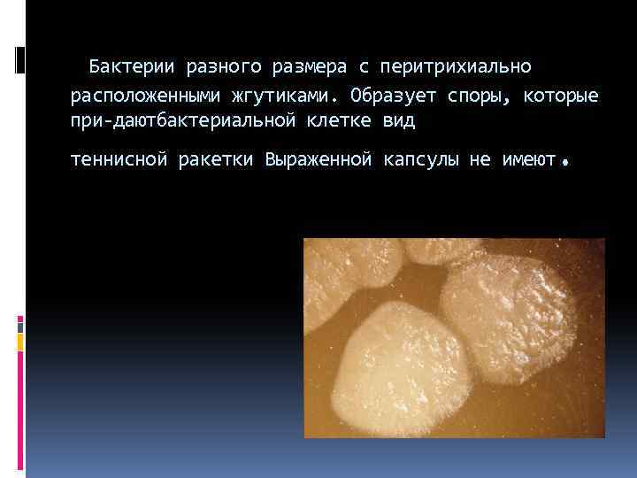  Бактерии разного размера с перитрихиально расположенными жгутиками. Образует споры, которые при дают актериальной