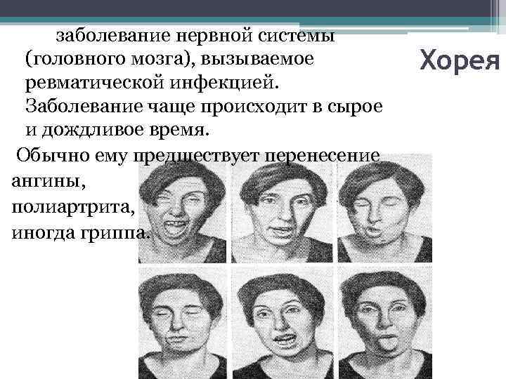 Инфекционные заболевания нервной системы презентация