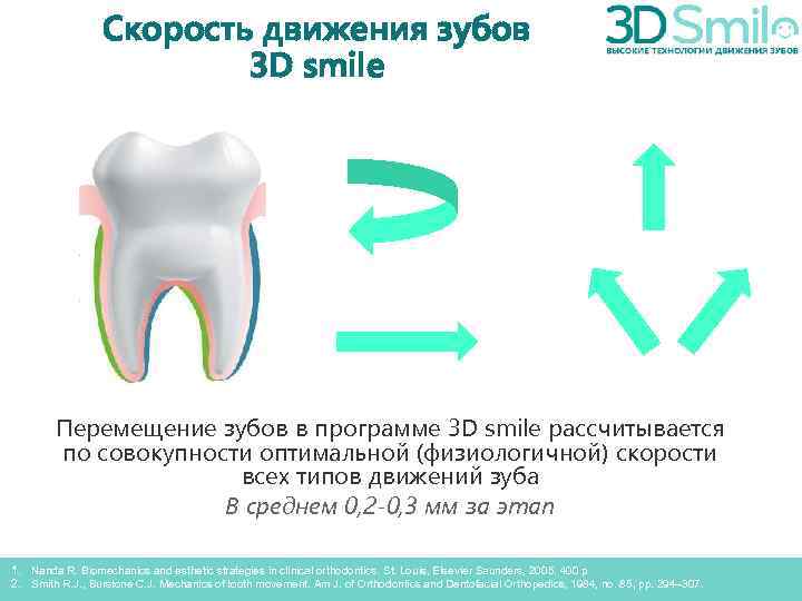 Скорость движения зубов 3 D smile Перемещение зубов в программе 3 D smile рассчитывается