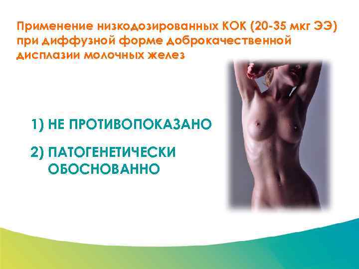 Специализированный семинар Применение низкодозированных КОК (20 -35 мкг ЭЭ) при диффузной форме доброкачественной дисплазии