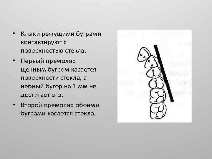 Постановка искусственных зубов по васильеву презентация