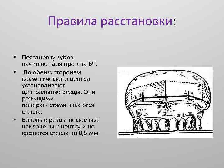 Постановка искусственных зубов по васильеву презентация