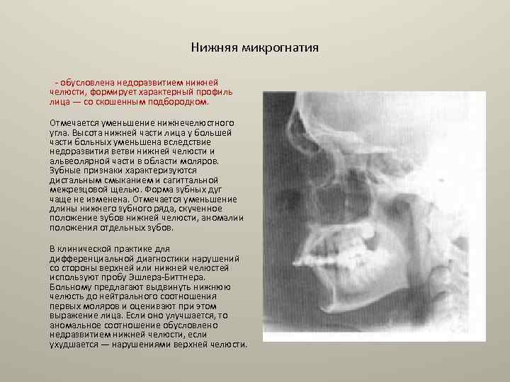 Оперативное лечение при аномалиях и деформациях верхней челюсти презентация