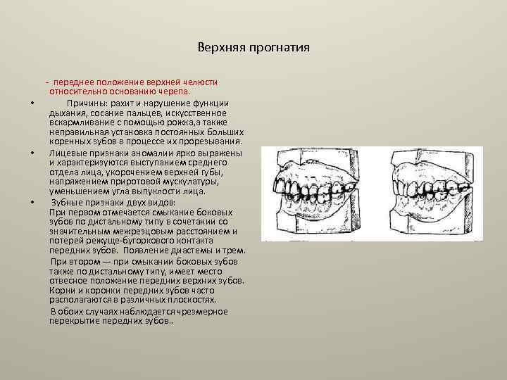 Оперативное лечение при аномалиях и деформациях верхней челюсти презентация