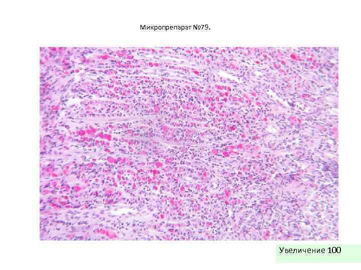 Микропрепарат № 79. Увеличение 100 