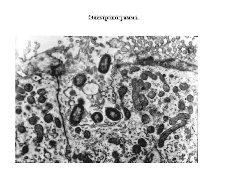 Электронограмма. 