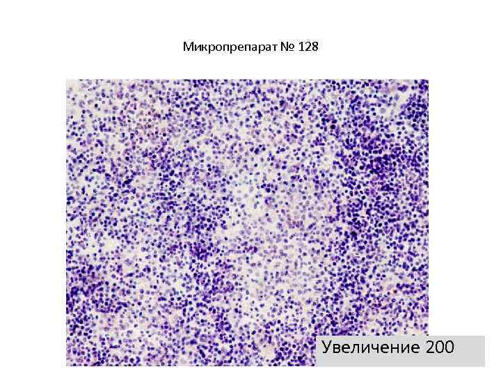 Микропрепарат № 128 Увеличение 200 