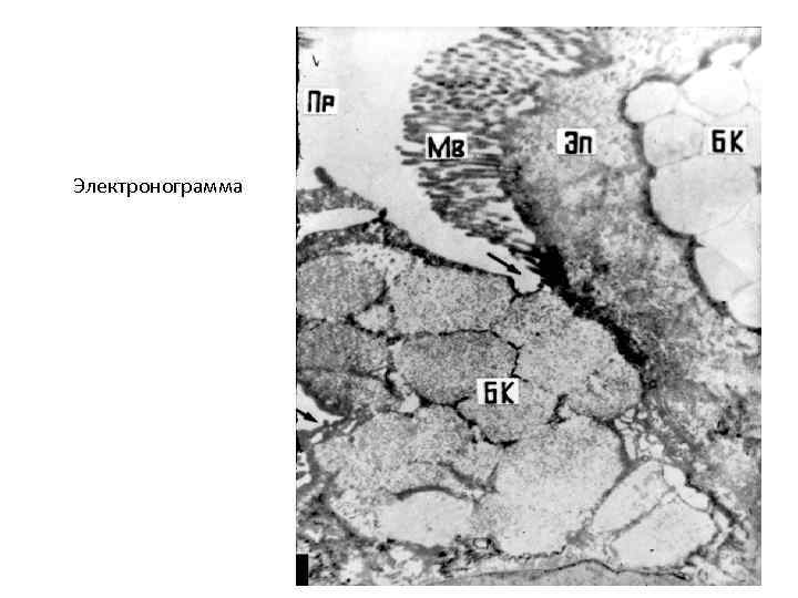 Электронограмма 