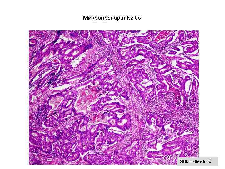 Микропрепарат № 66. Увеличение 40 