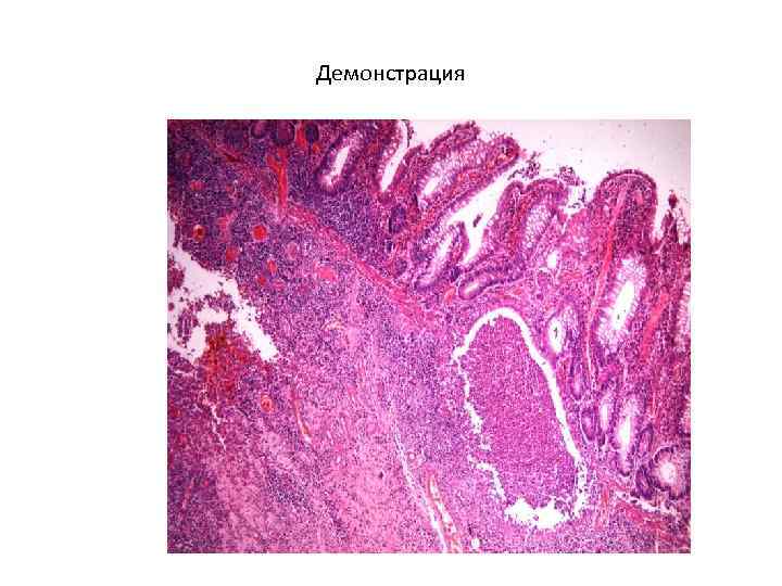 Демонстрация 