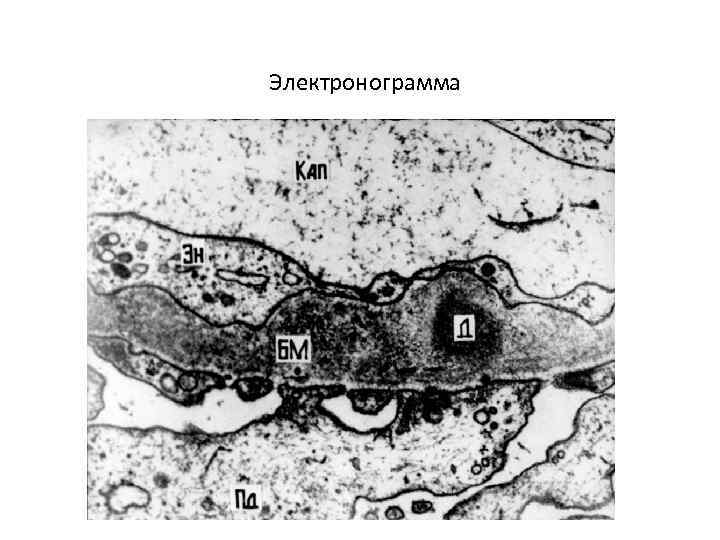 Электронограмма 