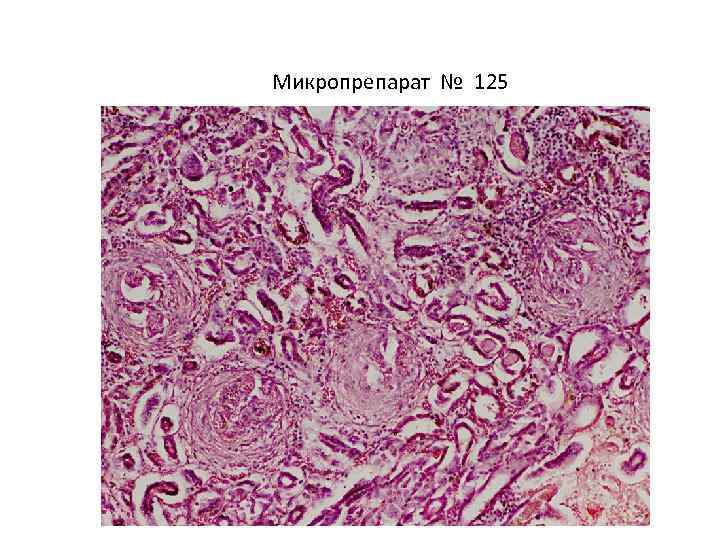 Микропрепарат № 125 