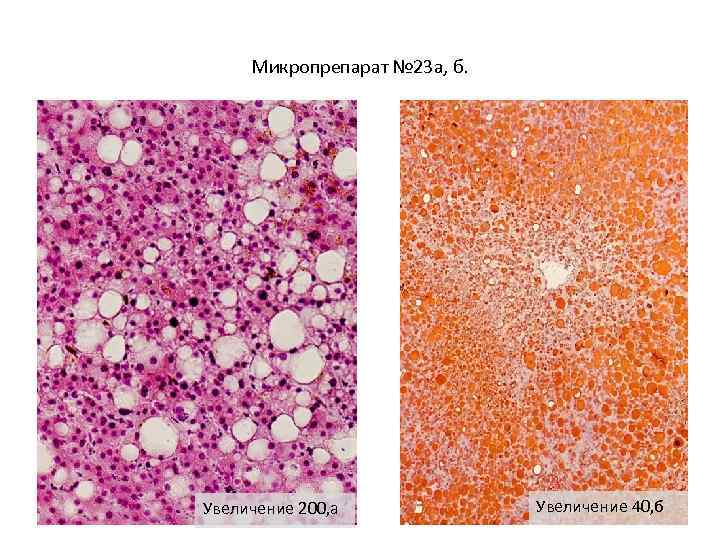 Микропрепарат № 23 а, б. Увеличение 200, а Увеличение 40, б 