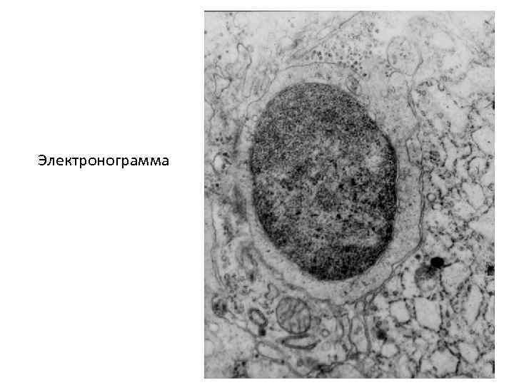 Электронограмма 