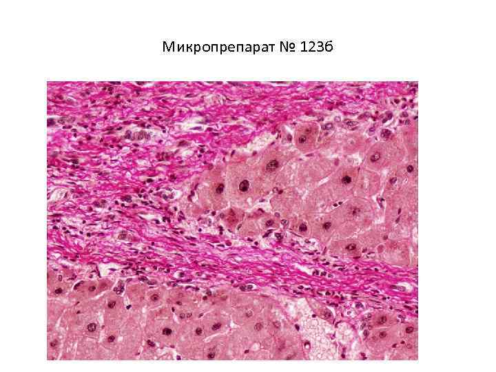 Микропрепарат № 123 б 