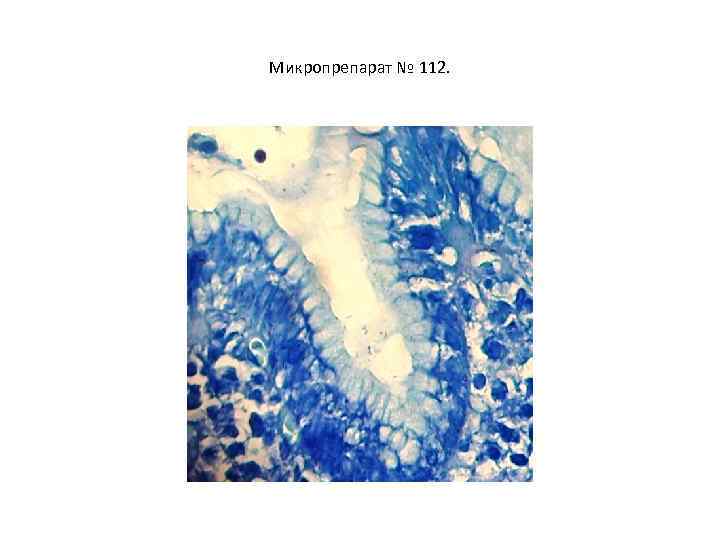 Микропрепарат № 112. 