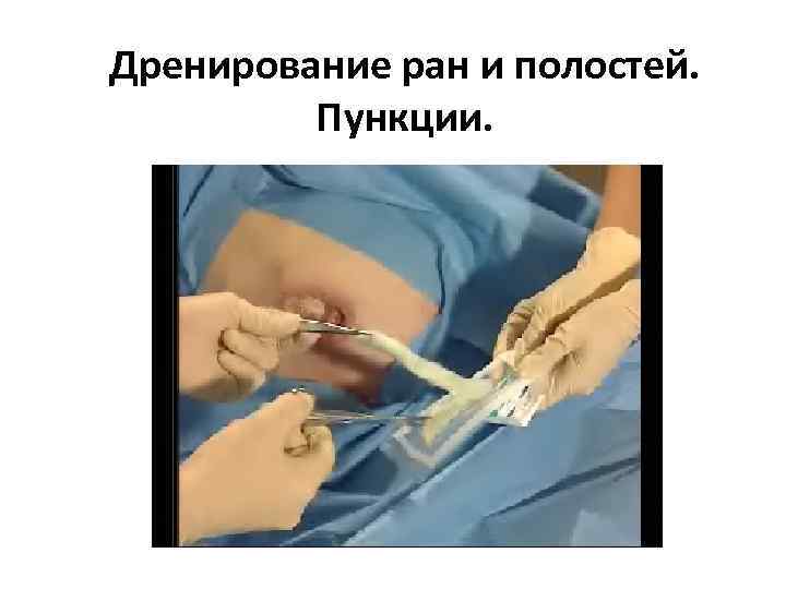 Дренирование ран и полостей. Пункции. 