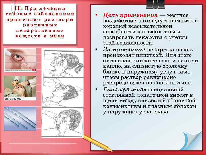 II. При лечении глазных заболеваний применяют растворы различных лекарственных веществ и мази • Цель