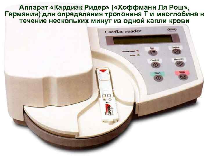 Аппарат «Кардиак Ридер» ( «Хоффманн Ля Рош» , Германия) для определения тропонина Т и