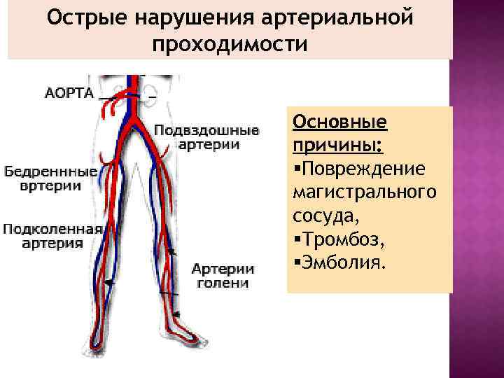 Острые нарушения артериальной проходимости Основные причины: §Повреждение магистрального сосуда, §Тромбоз, §Эмболия. 