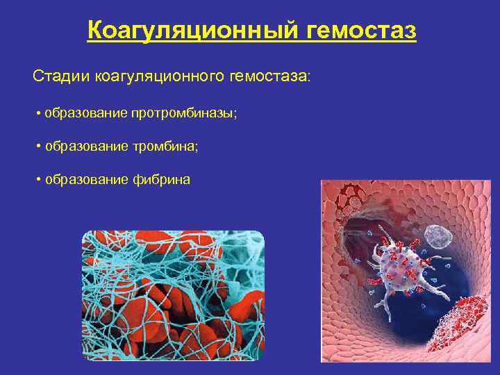 Коагуляционный гемостаз. Этапы коагуляционного гемостаза. 2 Фаза гемокоагуляционного гемостаза. Фазы коагуляции гемостаза. Коагуляционный гомеомтаз.